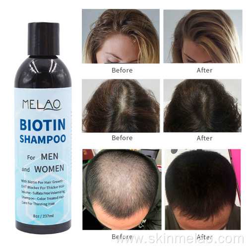 Biotin Hair Shampoo For Men And Women